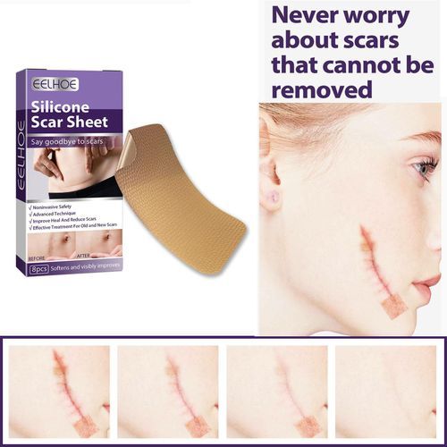 Silicone  Sheets For Scars Caused By , Keloid,