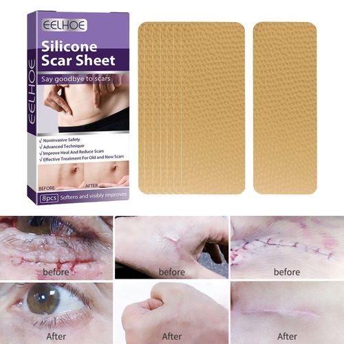 Silicone  Sheets For Scars Caused By , Keloid,