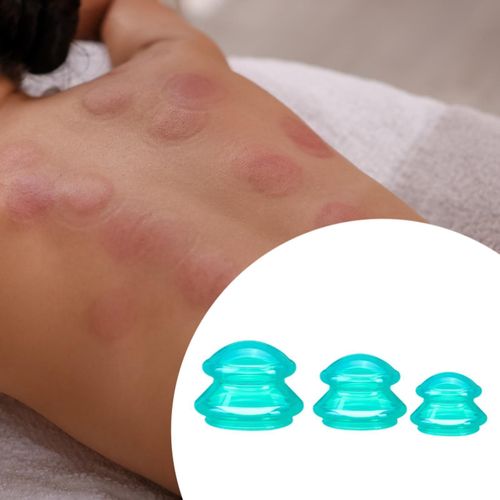 3Pcs Suction Cup Massage Cup Chinese Massage Cups For