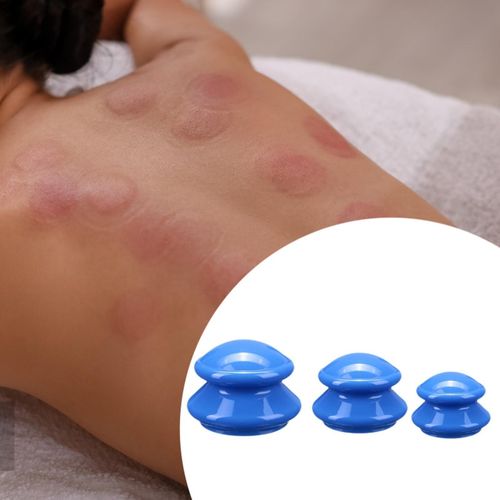 3Pcs Suction Cup Massage Cup Chinese Massage Cups Dark