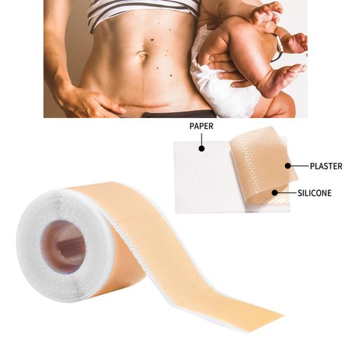 Scars  Treatment Tapes Highly   Removal -Section