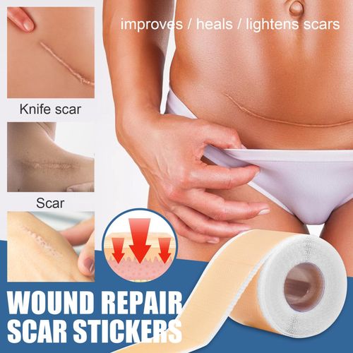 Scars  Treatment Tapes Highly   Removal -Section