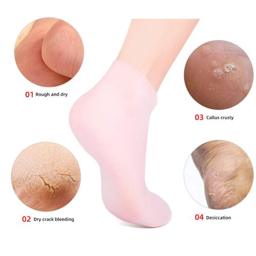 Silicone Gel Heel Socks Feet Care Socks for Pink S