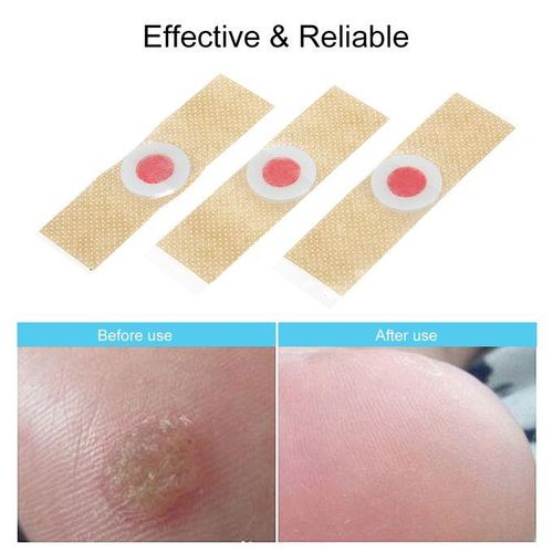18PCS Corn Remover Wart Remover Foot Corn Remover Pads Corn