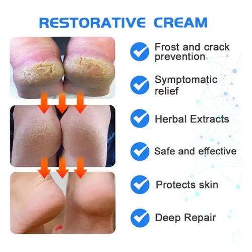 Dry Cracked heel balm Callus Remover foot cream repair Moisturizing