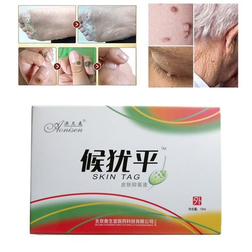 All Natural Skin Tag Warts Removal Liquid Foot Corn Removal Skin Care