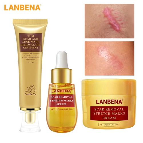 Lanbena  Scar Remover Cream+Gel+Serum