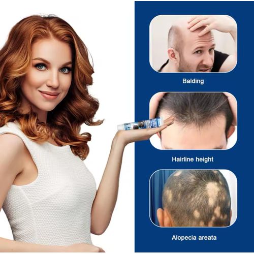 Lanbena Sumifun Alopecia Hair Growth Cream: Your Ultimate Solution to Hair Loss