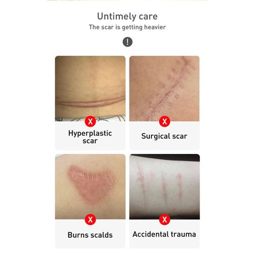 Lanbena Tcm Scar Removal & Skin Care Gel - 30g