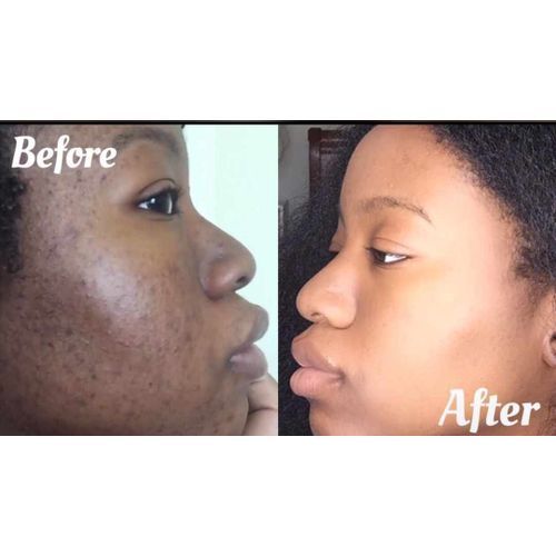 AIM GLOBAL Angel-E-10 Softgels,Anti-aging,Skin Lightening Beauty Supplement For Women.