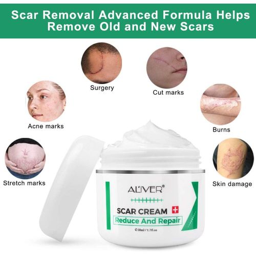 Lanbena Scar Cream Reduce And Repair - 50g