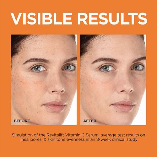 L'Oreal Revitalift 12% Pure Vitamin C Serum, Vitamin E, Salicylic Acid, Moisturizing, Smoothing & Brightening, 30ml