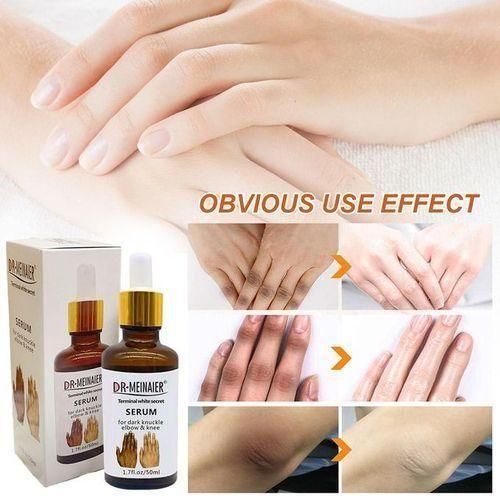 Dr meinaier Strong Dark Knuckles Removal Serum - 50ml