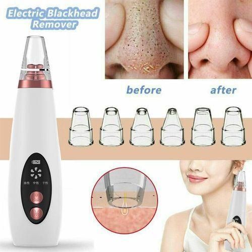 Black Head Suction Device  - White
