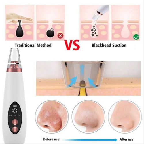 Black Head Suction Device  - White