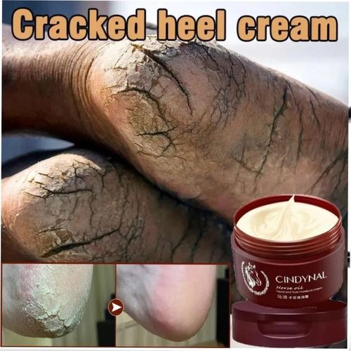 Foot & Hand Cream