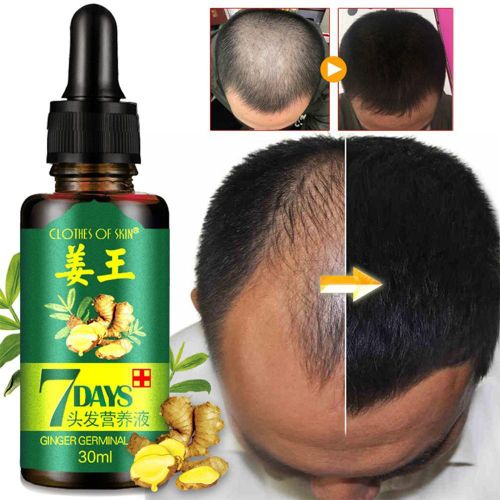 7 Day 7 Days Ginger Hair Growth Oil  - 30ml