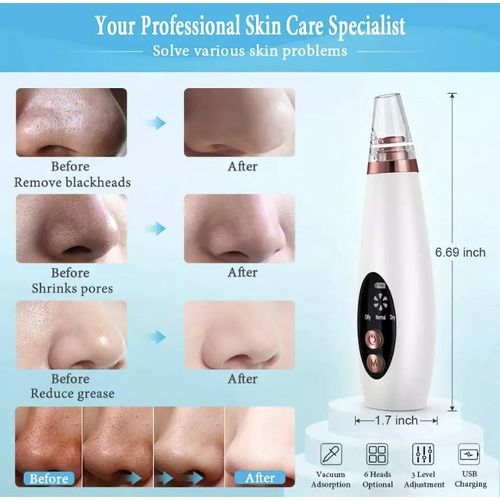 Black Head Remover Pore Cleaner Vacuum Suction Facial Extractor