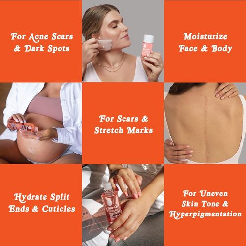 Genetic  Bio-Oil Skincare Body Oil, Serum for Scars and Stretchmarks, Face Moisturizer Dry Skin, Non-Greasy, Dermatologist Recommended, Non-Comedogenic, For All Skin...