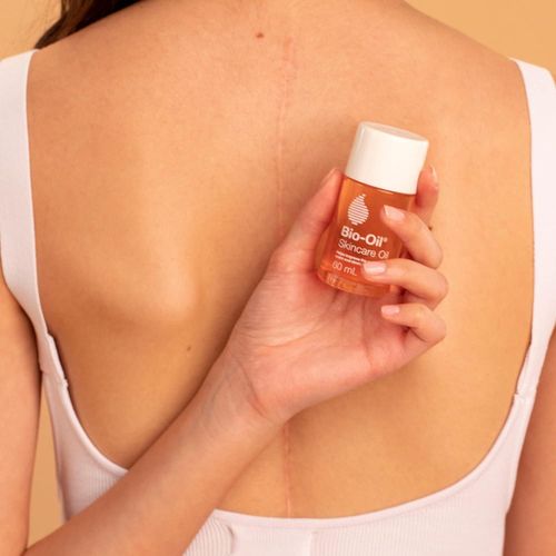 Genetic  Bio-Oil Skincare Body Oil, Serum for Scars and Stretchmarks, Face Moisturizer Dry Skin, Non-Greasy, Dermatologist Recommended, Non-Comedogenic, For All Skin...