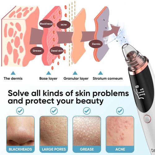 Beauty Tools Blackhead Remover Vacuum