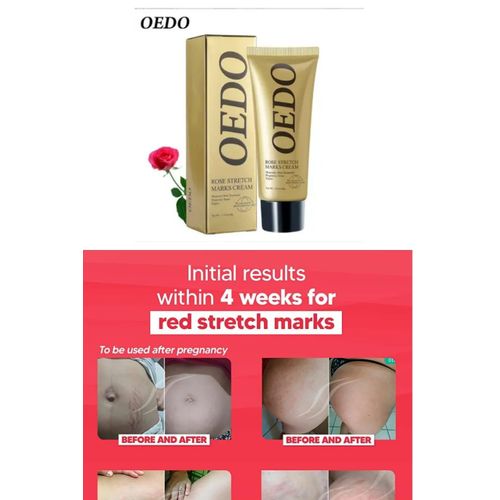 Oedo Stretch Marks Removal Cream - 1pc