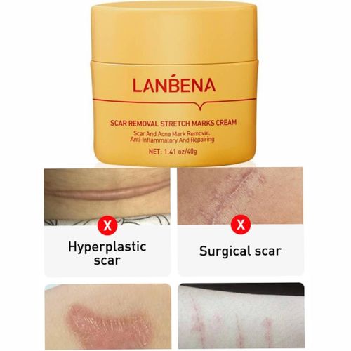 Lanbena Scar Removal Stretch Marks Cream Skin Repair Night Cream - 40g