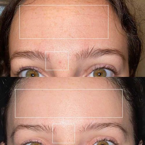 Retinol Wrinkle Repair Face Cream - 30g