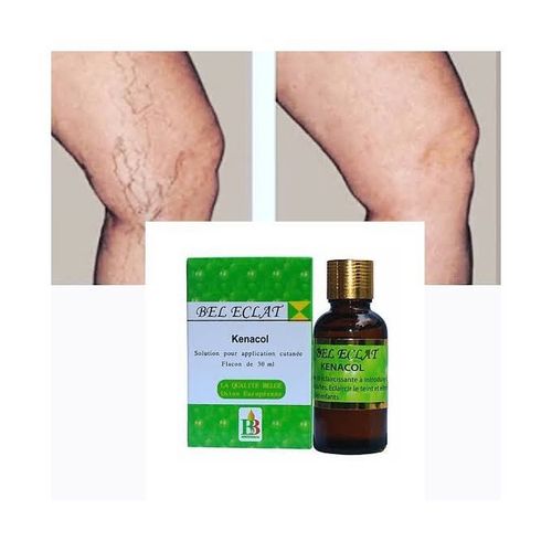 Stretch Bel Eclat Kenacol Oil Green Veins Stretch Marks Remover