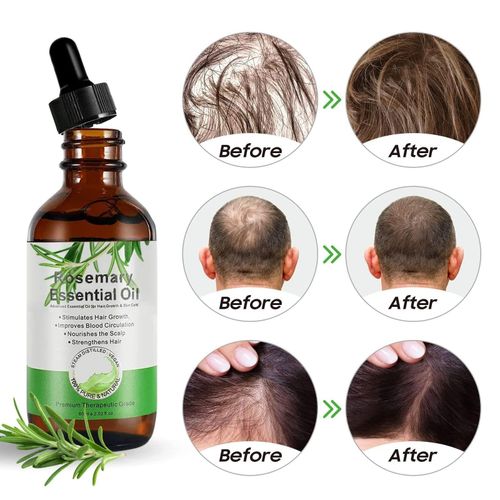 Aliver Pure Rosemary Essential Oil for Hair Loss Growth and Reduction, Treating Skin and Improving Sleep - 60mls