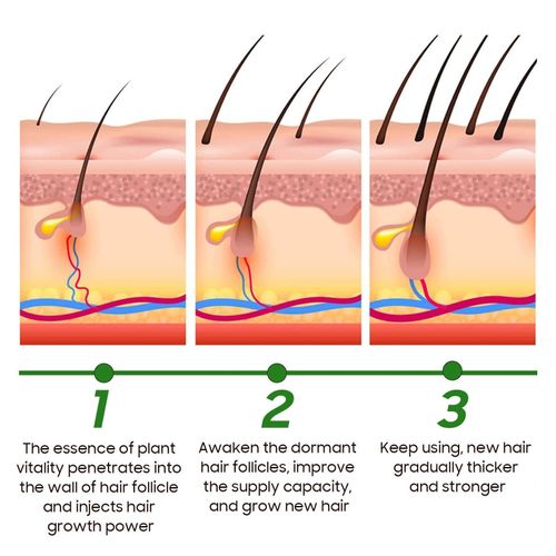 Aliver Pure Rosemary Essential Oil for Hair Loss Growth and Reduction, Treating Skin and Improving Sleep - 60mls