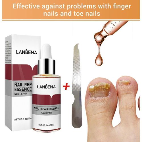 Lanbena Nail Repair Essence Serum Fungal Nail Treatment Remove Onychomycosis Toe Nourishing Brighten Hand Foot Skin Care 12ml