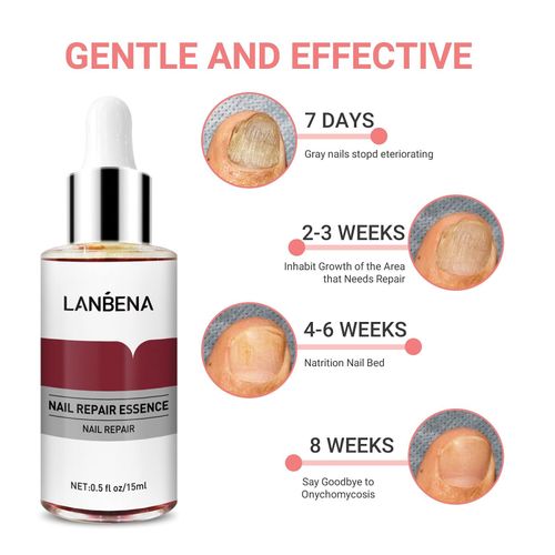 Lanbena Nail Treatment Nail Care Serum Protect Nail from Damage Fingernail and Toenail Repair for Curing Athlete's Foot and Prevent Nail from Infection Discoloured & Damaged Nails(15ml)