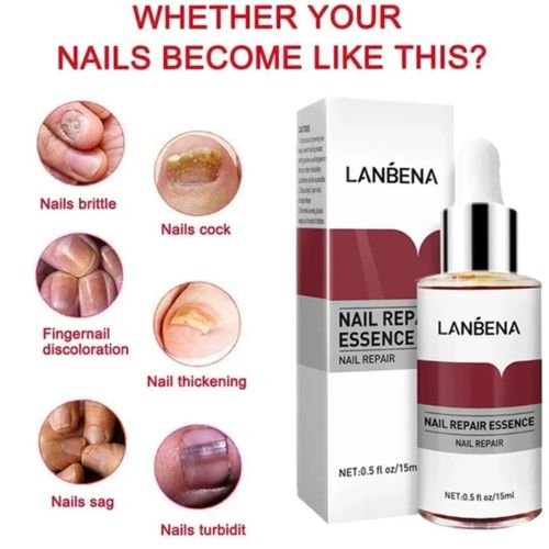 Lanbena Nail Repair Essence