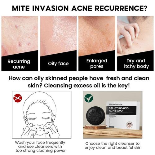 Cerave Acne Control Cleanser With Salicylic - 100g