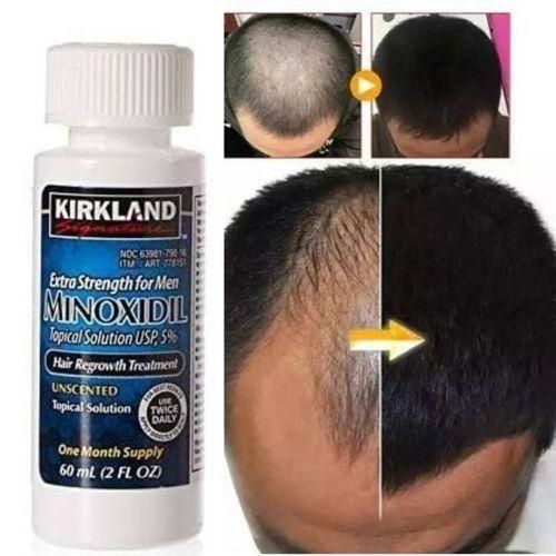 Kirkland Minoxidil   5% Men Hair Growth Oil Anti Baldness Oil Extra Strength Hair Regrowth Oil - 60ml