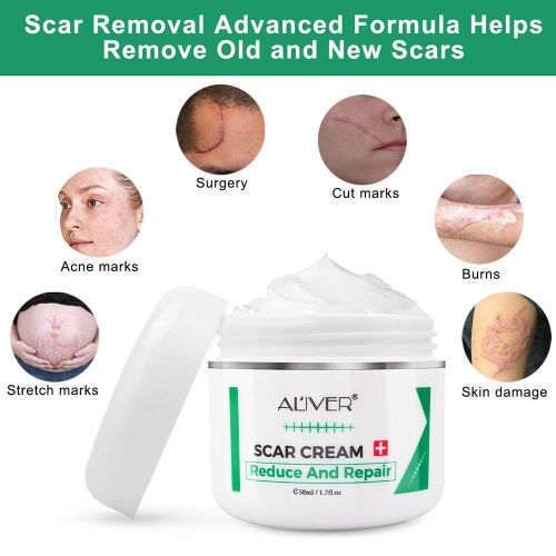 Aliver Scar Cream, Stretch Marks Remover, Ideal for Acne, C-Section, Burns, Surgical Scars Treatment, Effective for Old and New Scars