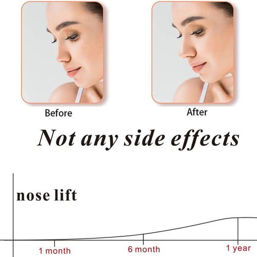 Nose Shaper Clipper- Blue(1pc)