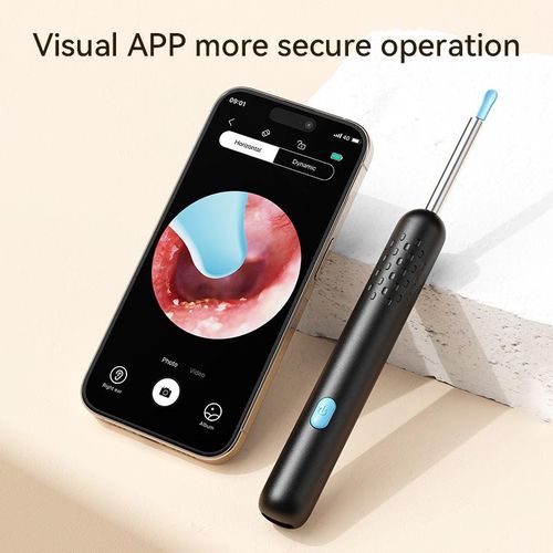 Ear Wax Removal - Wireless WiFi Visual Rechargeable Ear Cleaner, Home Tool for Earwax Removal, 1080P HD Camera Lens &  Ear Set - Ear Cleaning Kit with Ear Pick