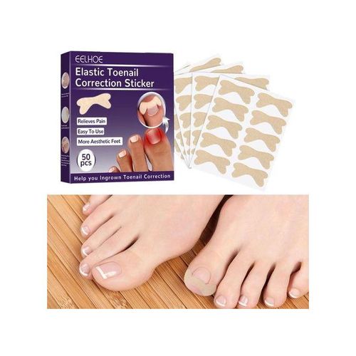 Toenail Corrector Patch  Free Ingrown Toenail Sticker For Toe Nail