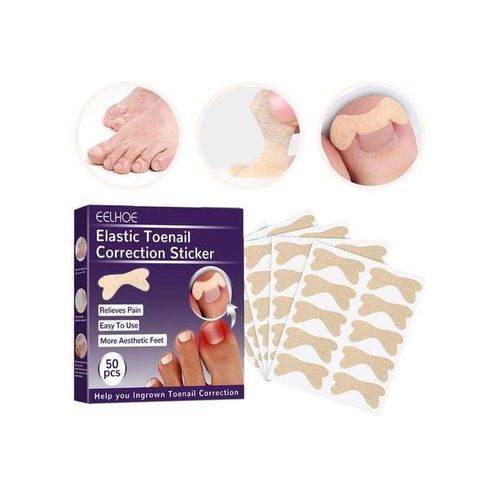 Toenail Corrector Patch  Free Ingrown Toenail Sticker For Toe Nail