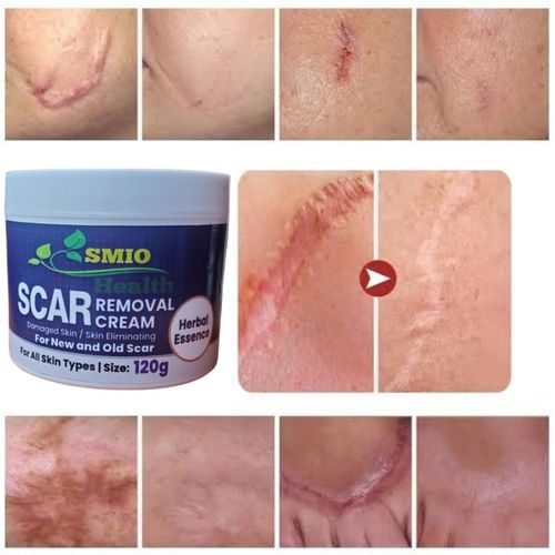 SMIO HEALTH Rapid Scar Remover Old And New Scars Achieve Smooth, Scar-Free Skin 120g