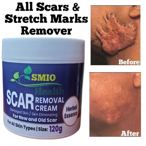 SMIO HEALTH Rapid Scar Remover Old And New Scars Achieve Smooth, Scar-Free Skin 120g