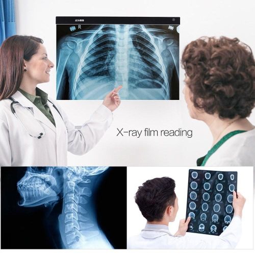 A2 Large Ultra-thin LED Light Pad Box Painting Tracing Panel Copyboard Stepless Adjustable Brightness USB Powered for Cartoon Tattoo Tracing Pencil Drawing X-Ray Viewing NO5138