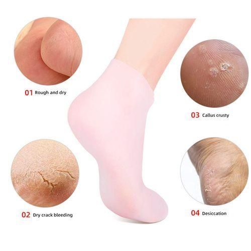 Foot SPA  Silicone Socks , Remove Calluses Corns Foot Care Pink M