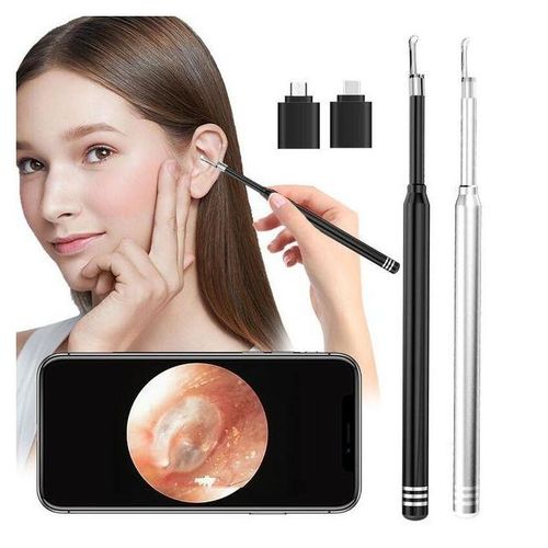 5.5mm Smart Visual Ear Cleaner Otoscope 3 In 1 Usb Otoscope Ear Wax Cleaning Inspection Camera Tools For Phone Pc