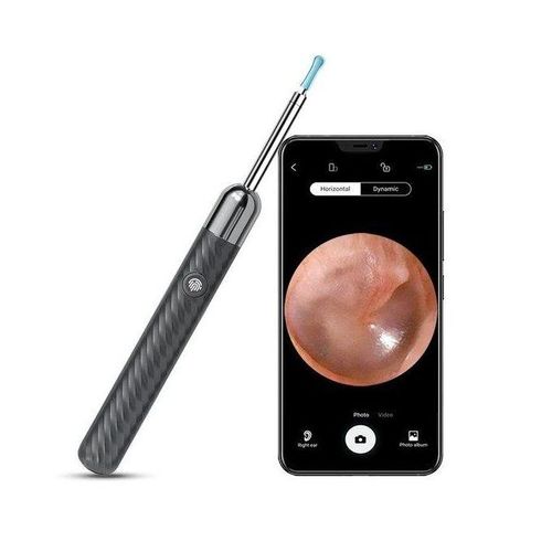 1080p Ear Wax Cleaner 1000w High Precision Ear Wax Removal Tool With Camera Led Wireless Otoscope Smart Ear Cleaning Kit