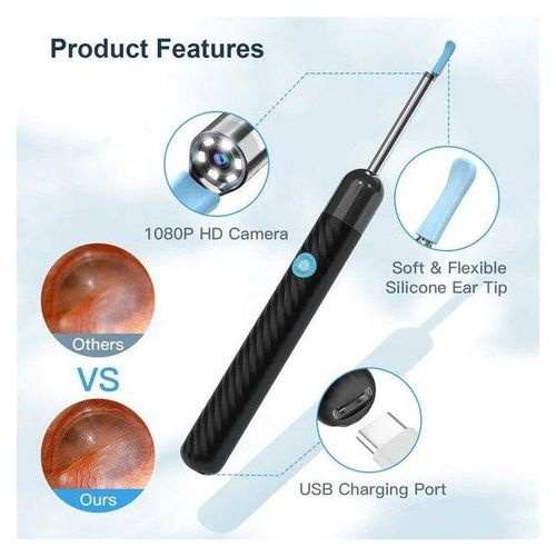 1080p Ear Wax Cleaner 1000w High Precision Ear Wax Removal Tool With Camera Led Wireless Otoscope Smart Ear Cleaning Kit