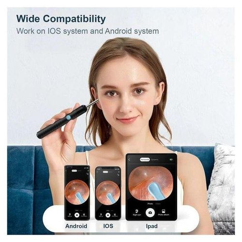 1080p Ear Wax Cleaner 1000w High Precision Ear Wax Removal Tool With Camera Led Wireless Otoscope Smart Ear Cleaning Kit