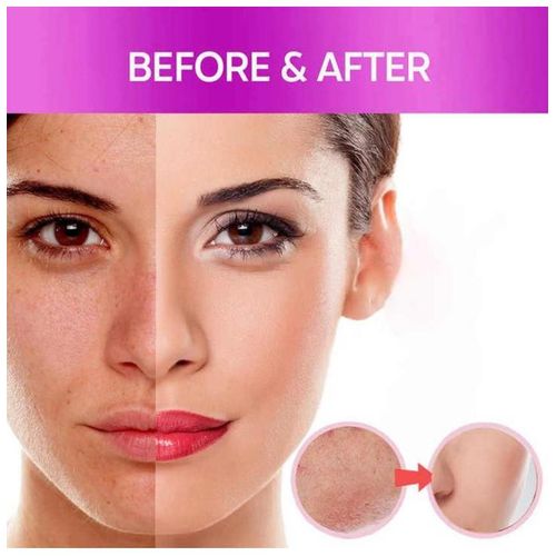 5D Gluta dark spot correcteur